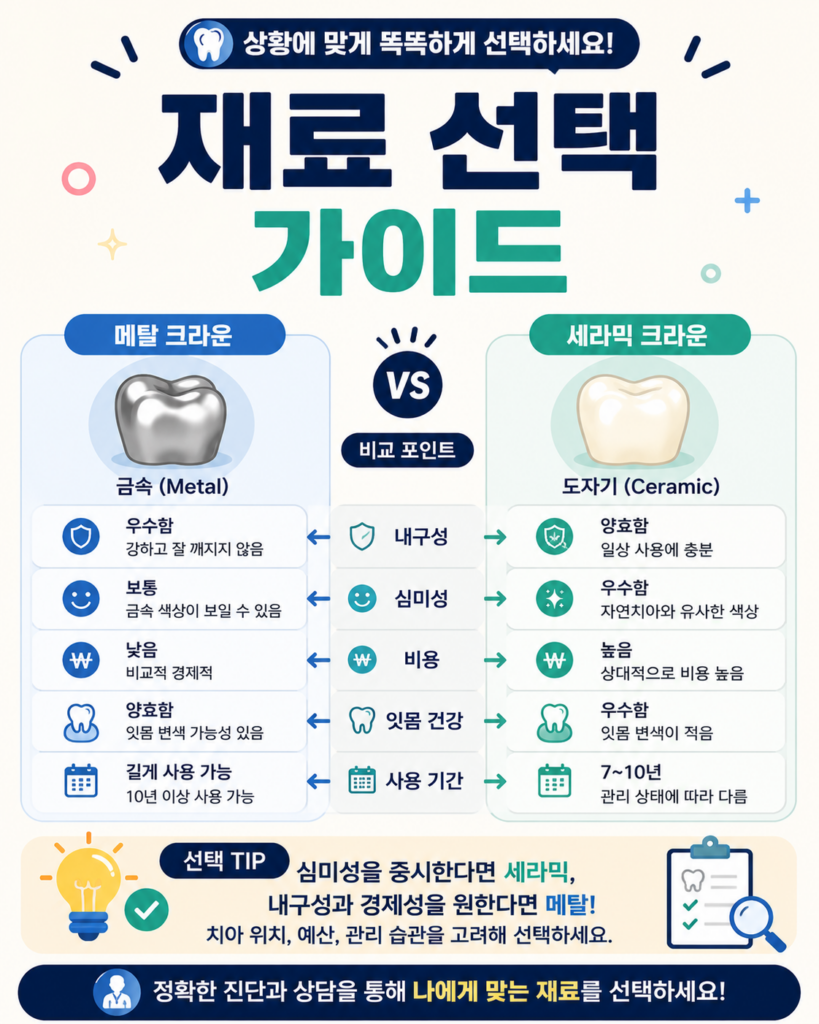 임플란트 크라운 재료 선택 가이드