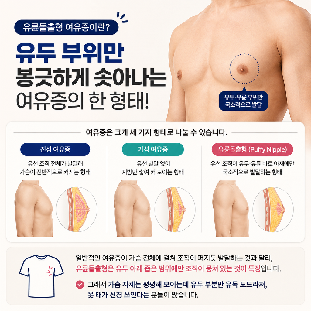 유륜돌출형 여유증, 유두만 볼록한 이유와 해결법