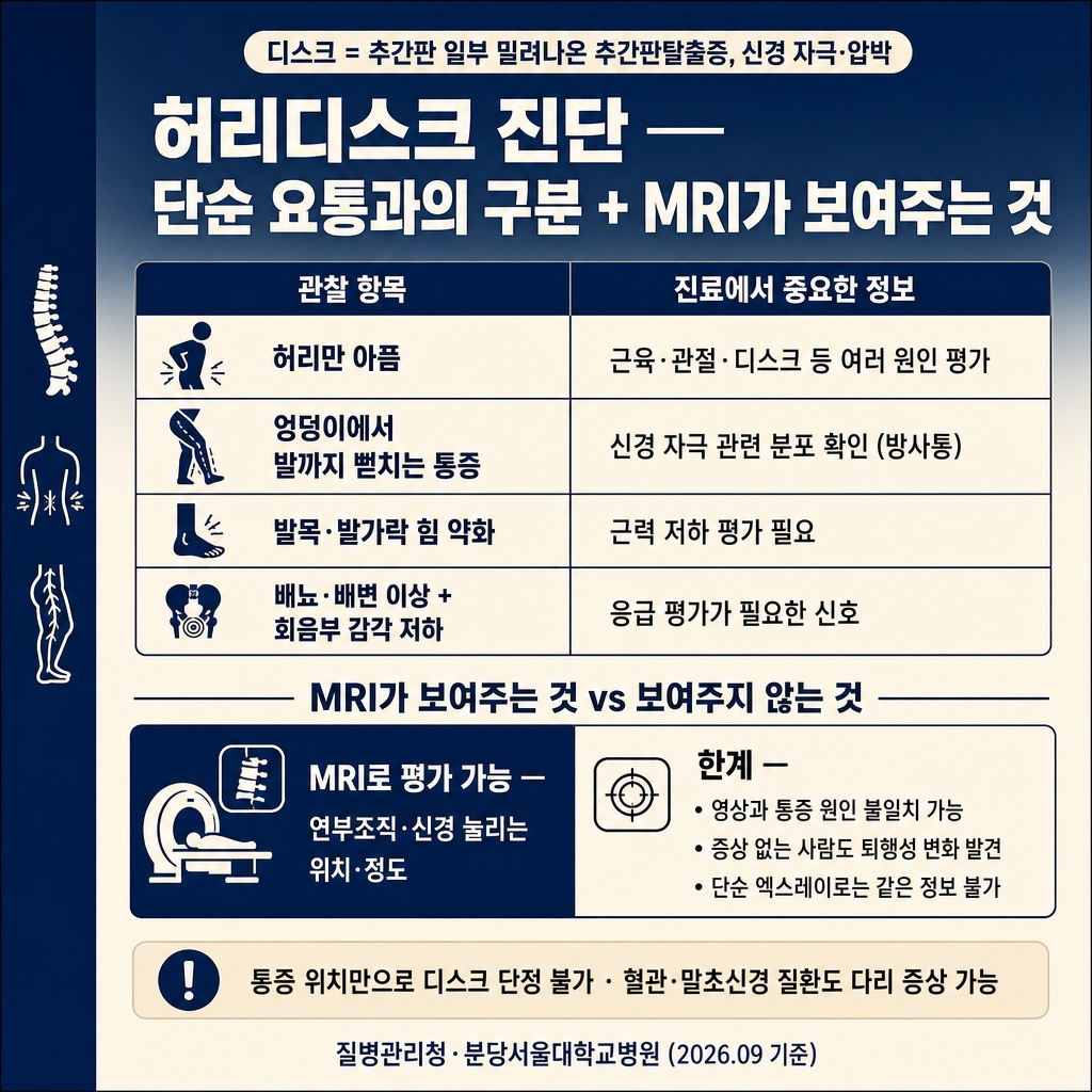 허리디스크 증상과 치료: 다리 저림·MRI·수술이 필요한 경우 1 딥네이비에서 크림으로 이어지는 상하 그라디언트 배경, 좌측 네이비 세로 띠가 전체 높이의 약 8% 폭으로 배치됨. 상단에 굵은 한글 산세리프 제목 ‘허리디스크 진단 — 단순 요통과의 구분 + MRI가 보여주는 것’. 제목 위에 작은 라운드 칩 ‘디스크 = 추간판 일부 밀려나온 추간판탈출증, 신경 자극·압박’. 중앙 4행 비교 표 2열 ‘관찰 항목 / 진료에서 중요한 정보’. 1행 ‘허리만 아픔 | 근육·관절·디스크 등 여러 원인 평가’. 2행 ‘엉덩이에서 발까지 뻗치는 통증 | 신경 자극 관련 분포 확인 (방사통)’. 3행 ‘발목·발가락 힘 약화 | 근력 저하 평가 필요’. 4행 ‘배뇨·배변 이상 + 회음부 감각 저하 | 응급 평가가 필요한 신호’. 표 아래 라벨 ‘MRI가 보여주는 것 vs 보여주지 않는 것’ 2열 대비 박스. 좌측 네이비 패널 흰 글씨 ‘MRI로 평가 가능 — 연부조직 · 신경 눌리는 위치 · 정도’. 우측 크림 패널 진한 글씨 ‘한계 — 영상과 통증 원인 불일치 가능 · 증상 없는 사람도 퇴행성 변화 발견 · 단순 엑스레이로는 같은 정보 불가’. 부드러운 크림 안내문 ‘통증 위치만으로 디스크 단정 불가 · 혈관·말초신경 질환도 다리 증상 가능’. 하단 우측 푸터 ‘질병관리청·분당서울대학교병원 (2026.09 기준)’. 워터마크 없음, 1:1 1024×1024.