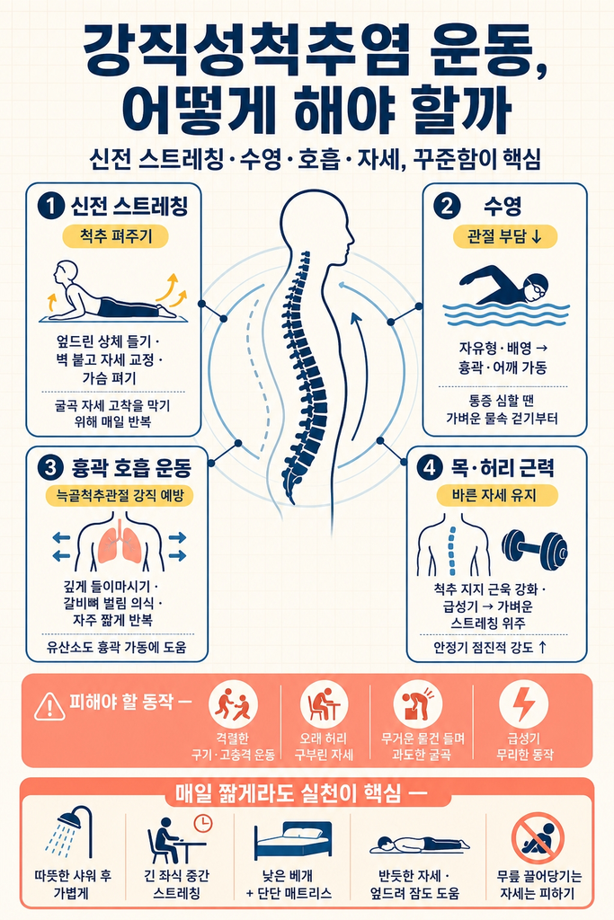 강직성척추염 운동, 척추 굳음을 늦추는 스트레칭법 1 강직성척추염 관리에서 약물 못지않게 중요한 운동의 역할 — 척추뼈 사이 관절과 인대의 반복 염증과 골화로 인한 척추 강직을 늦추기 위해 염증이 심하지 않은 시기부터 관절 가동범위를 꾸준히 유지해야 한다는 점과 동시에 늑골척추관절까지 침범되어 흉곽 가동이 줄면 숨이 차는 증상이 나타날 수 있어 흉곽 호흡 운동까지 함께 챙겨야 한다는 점, 엎드린 상체 들기·벽 붙고 자세 교정·가슴 펴기 같은 신전 스트레칭과 자유형·배영이 흉곽·어깨 가동범위를 넓히는 데 도움이 되는 수영, 깊게 들이마시기·갈비뼈 벌림을 의식하며 자주 짧게 반복하는 흉곽 호흡, 급성기에는 가벼운 스트레칭 위주로 하고 안정기에 점차 강도를 높이는 목·허리 근력 강화, 격렬한 구기 종목과 오랜 시간 허리 구부린 자세·무거운 물건 들며 과도하게 숙이는 동작을 피해야 한다는 점, 그리고 매일 짧게라도 끊지 않고 실천하는 꾸준함이 가장 중요하고 따뜻한 샤워 후 가볍게 움직이며 장시간 좌식 중에는 중간 스트레칭을 더하고 낮은 베개와 단단한 매트리스 위에서 반듯이 혹은 엎드려 자며 무릎을 끌어당기는 웅크린 수면 자세를 피해야 한다는 점을 정리한 안내