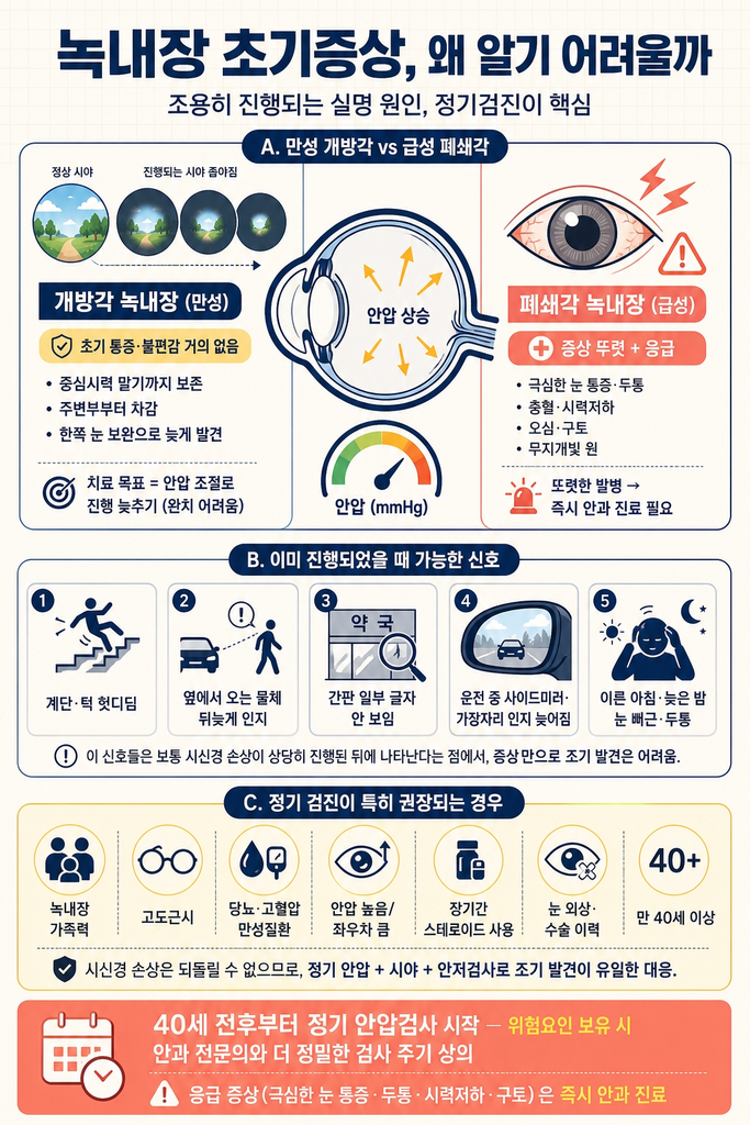 녹내장 초기증상, 시야 손상 전까지 왜 못 느낄까 1 조용히 진행되어 '조용한 실명 원인'으로 불리는 녹내장의 특성 — 시신경 손상이 진행되어도 한 번 손상된 시신경은 회복되지 않아 치료 목표가 안압 조절을 통한 진행 지연이며, 중심 시력은 말기까지 비교적 보존되고 주변부 시야부터 줄어드는 개방각 녹내장에서는 자각 증상이 거의 없고 한쪽 눈의 시야 결손을 다른 눈이 보완해 늦게 발견되는 경우가 많다는 점, 이미 진행된 경우 계단·턱 헛디딤이나 옆에서 오는 물체 인지 지연, 간판 일부 글자 안 보임, 운전 중 사이드미러·시야 가장자리 인지 늦어짐, 이른 아침·늦은 밤 안압 상승으로 인한 눈 뻐근함과 두통 같은 신호가 나타날 수 있다는 점, 반면 안압이 급격히 올라가는 폐쇄각 녹내장은 극심한 눈 통증·두통·충혈·시력 저하·구역·구토·무지개빛 원 증상이 나타나 안과 응급 진료가 필요한 점, 가족력·고도근시·당뇨·고혈압·안압 높음·스테로이드 장기 사용·눈 외상 이력·만 40세 이상인 경우 정기 안압·시야·안저검사를 통해 조기에 발견하는 것이 사실상 유일한 대응이며 40세 전후부터 기본 안압검사를 시작하고 위험요인 보유 시에는 안과 전문의와 더 정밀한 검사 주기를 상의해야 한다는 점을 정리한 안내