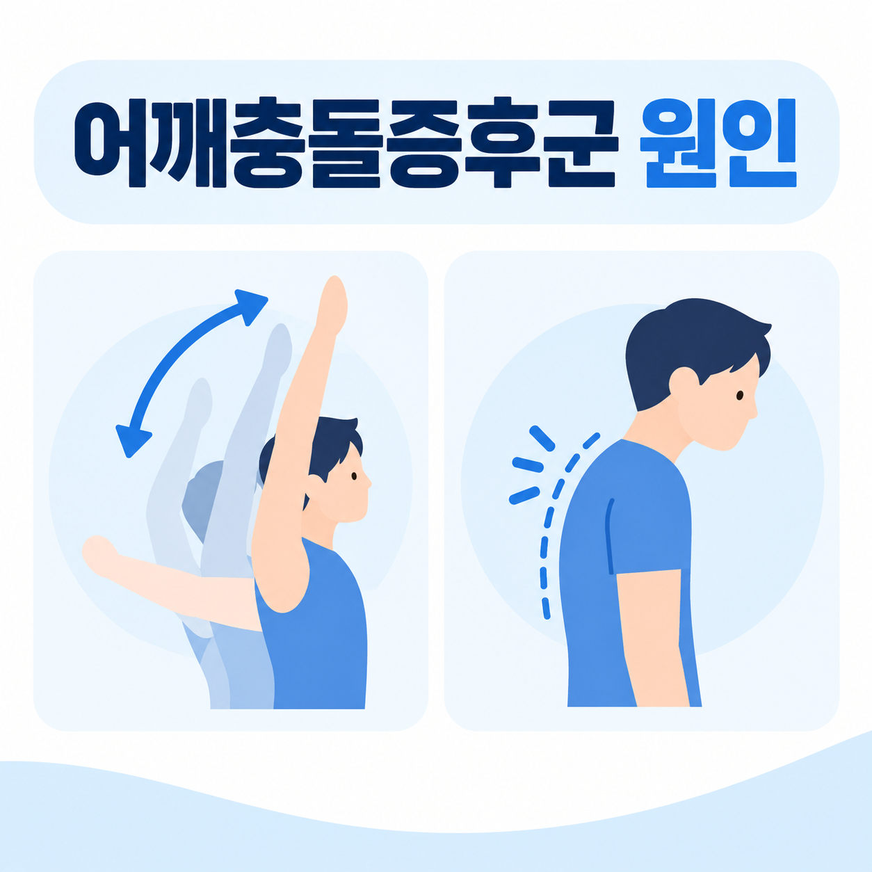 어깨충돌증후군 원인인 반복사용과 라운드숄더를 설명하는 카드뉴스 이미지