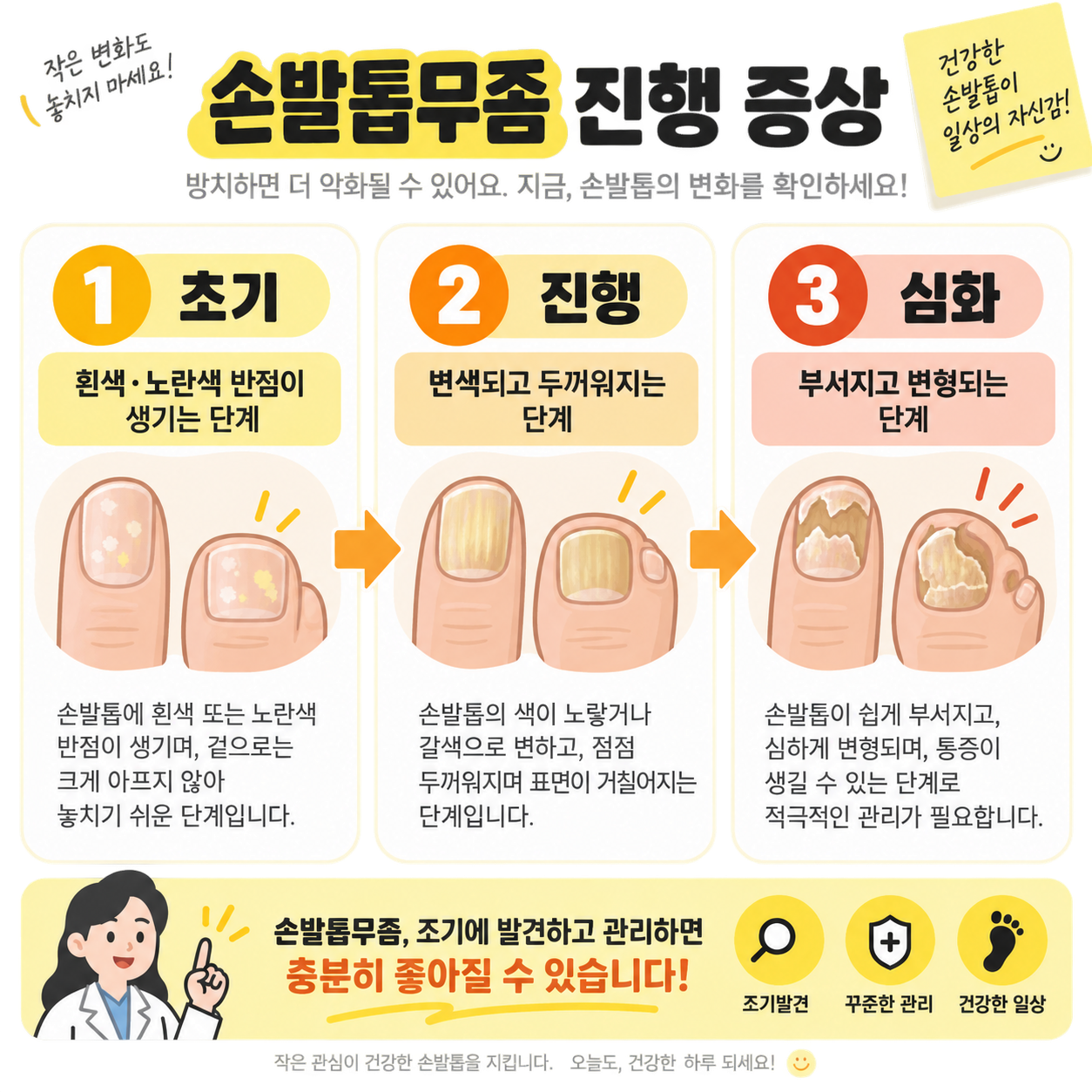 손발톱무좀 진행 단계별 증상을 정리한 카드뉴스 인포그래픽