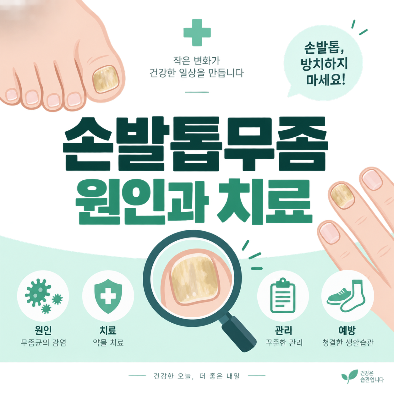 손발톱무좀 원인과 치료를 안내하는 미니멀 일러스트 썸네일
