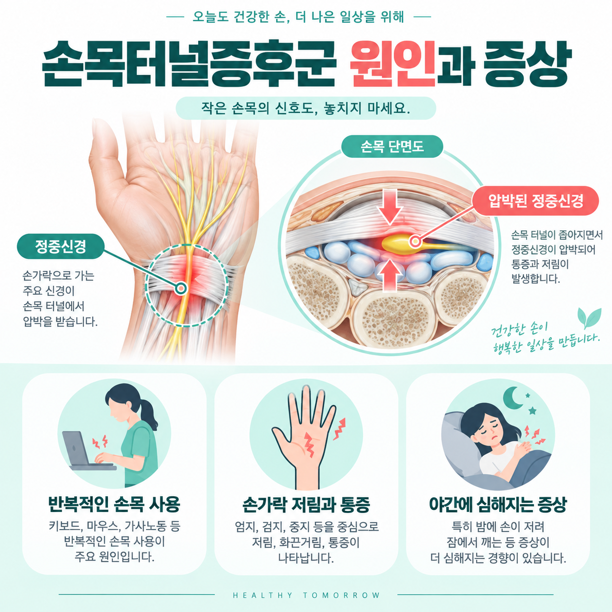 손목터널증후군 증상과 치료 방법 2 손목터널증후군의 원인과 반복적인 손목 사용, 손가락 저림, 야간 증상 악화를 설명하는 카드뉴스 인포그래픽