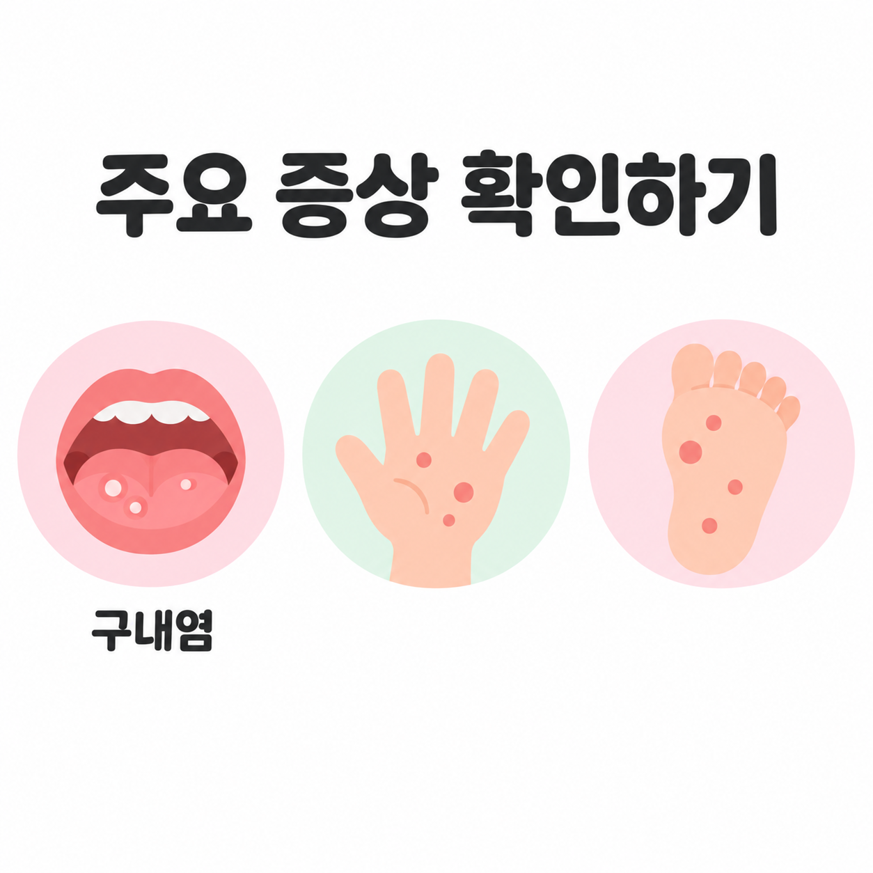 수족구병 증상과 치료, 어린이집 등원중지 기준 총정리 2 수족구병 주요 증상을 보여주는 카드뉴스 이미지, 입과 손과 발의 발진 부위 아이콘