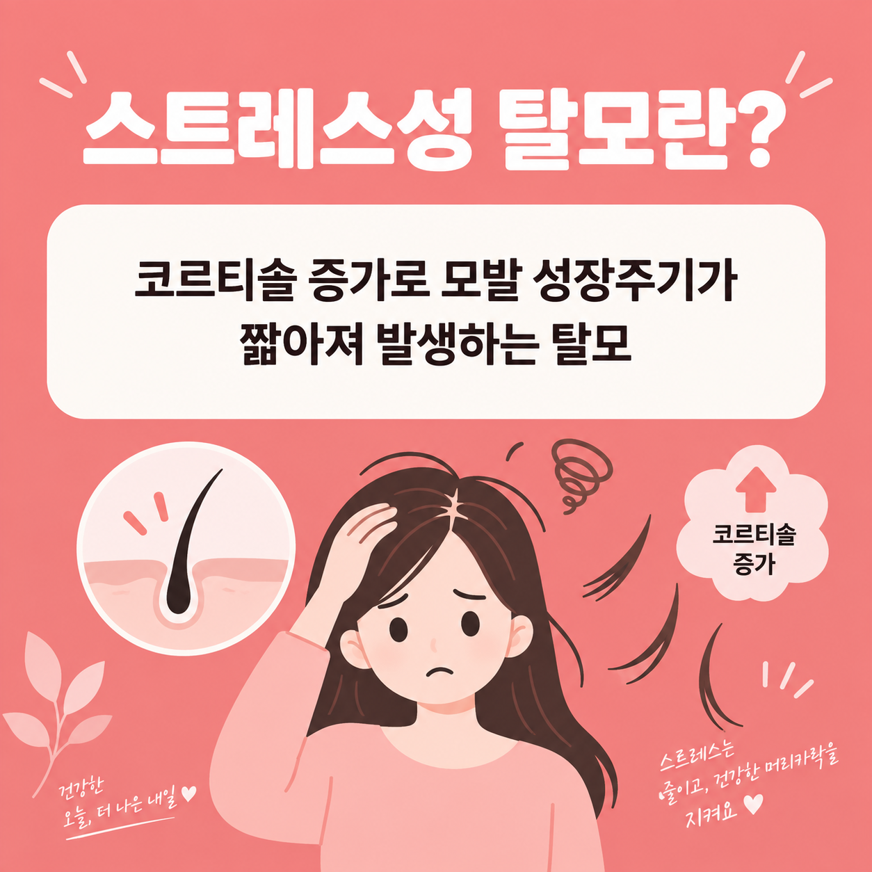 스트레스성 탈모 원인과 회복방법, 언제까지 지켜봐야 할까 1 스트레스성 탈모의 정의를 설명하는 카드뉴스 이미지