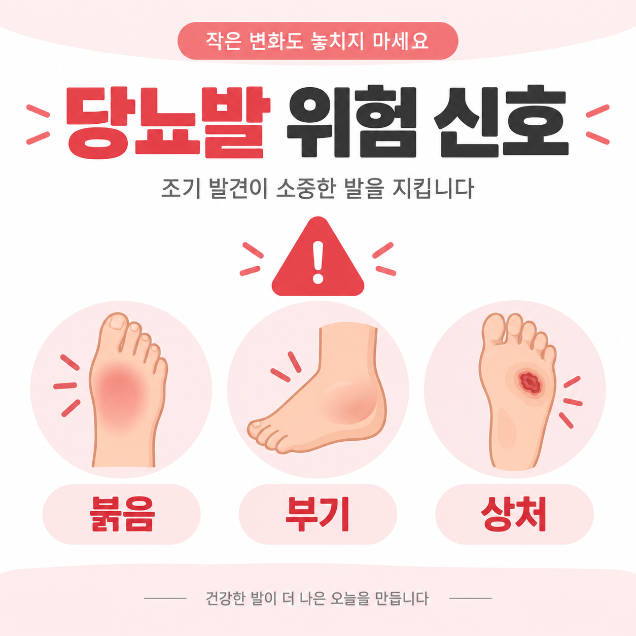 당뇨발 궤양 위험 신호를 설명하는 카드뉴스 이미지