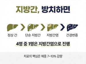 지방간 방치하면 4명 중 1명 지방간염, 체중 7%가 기준입니다 3 지방간 진행 단계 카드뉴스 - 정상 간에서 단순 지방간, 지방간염, 간경변증으로 진행, 4명 중 1명은 지방간염으로 진행, 치료의 핵심은 체중 7~10% 감량