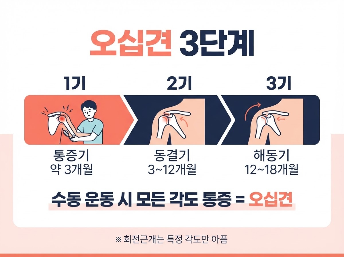 오십견 3단계와 회전근개 구분법, 3개월이 갈림길입니다 1 오십견 3단계 카드뉴스 - 1기 통증기 약 3개월, 2기 동결기 3~12개월, 3기 해동기 12~18개월, 수동 운동 시 모든 각도 통증이면 오십견, 회전근개는 특정 각도만 통증
