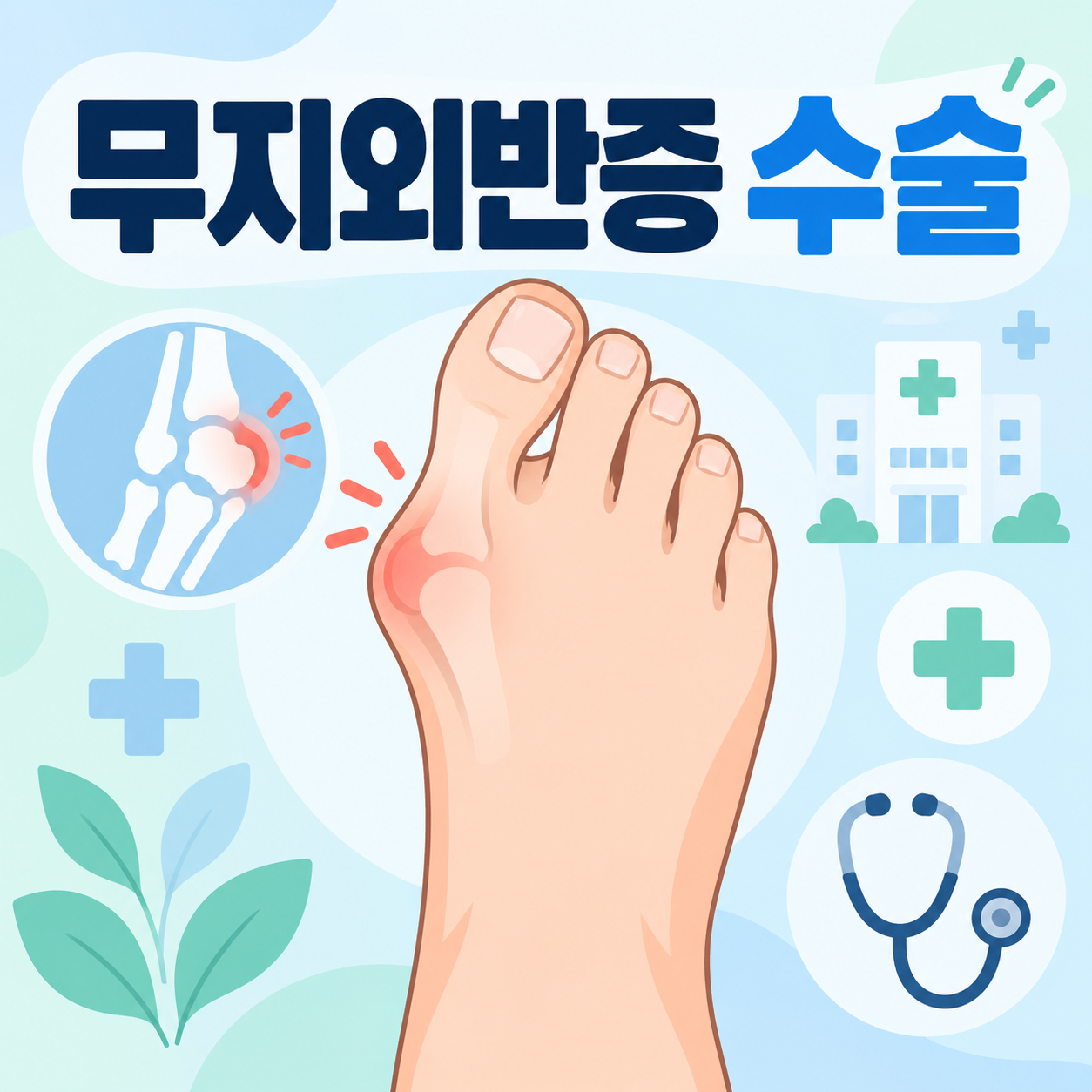 무지외반증 수술 안내 썸네일