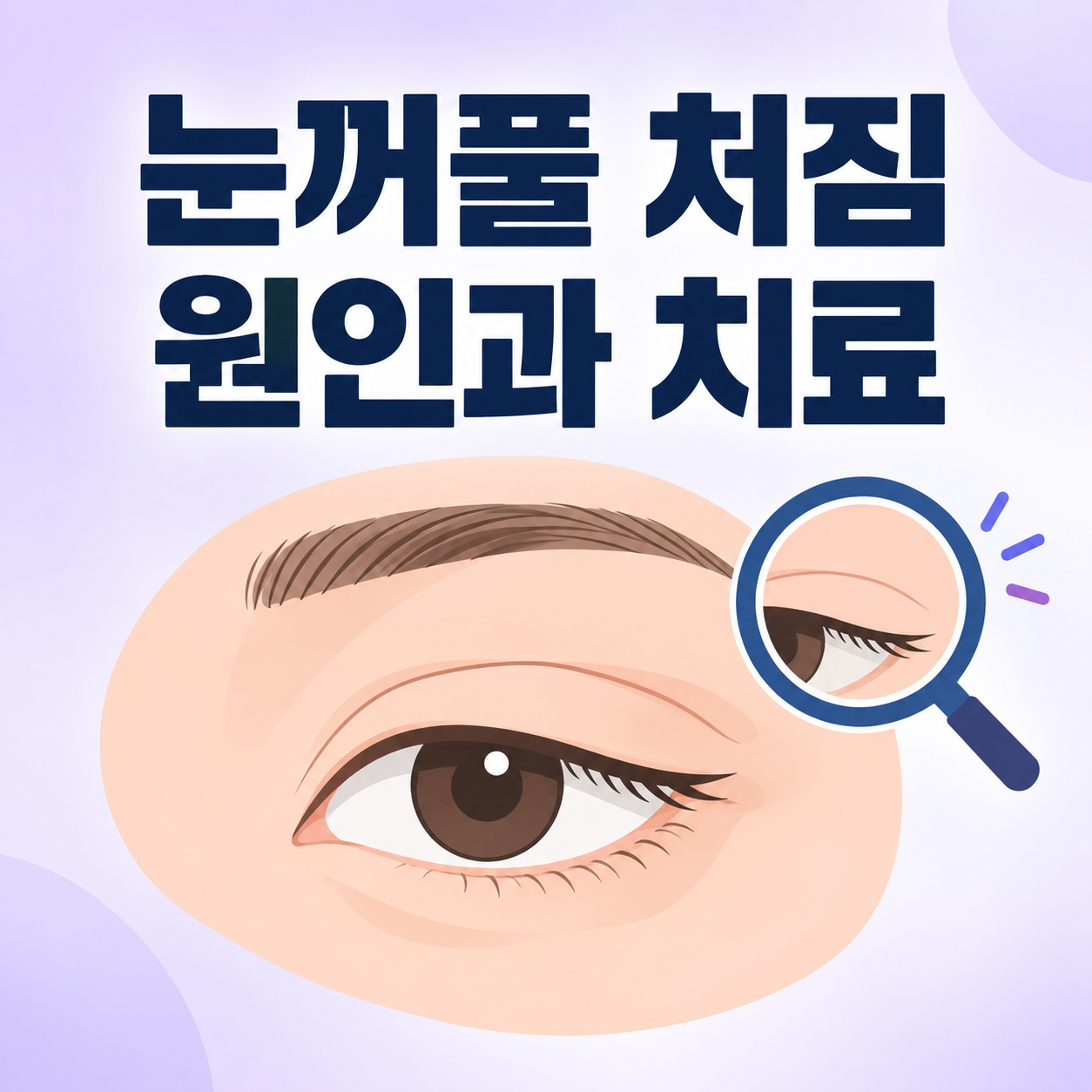 눈꺼풀 처짐 원인과 치료를 설명하는 썸네일 이미지